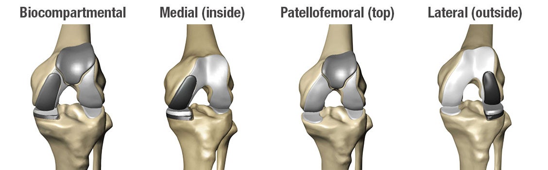 Knee Bone Anatomy