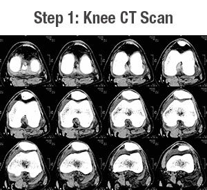 Knee CT Scan