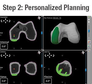 Personalized Planning