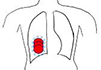 Conventional Radiotherapy Systems