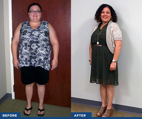 before and after bariatric results photos of angel broussard