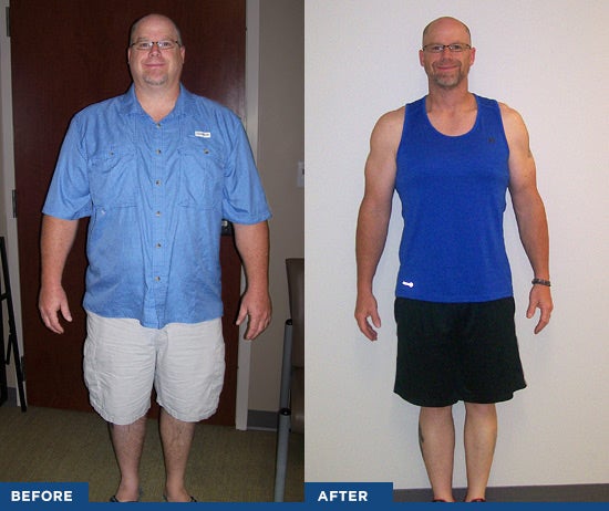 before and after bariatric results photos of brad broussard