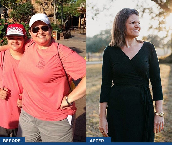 before and after bariatric results photos of dawn freeman