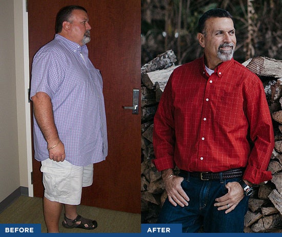 before and after bariatric results photos of patrick landry